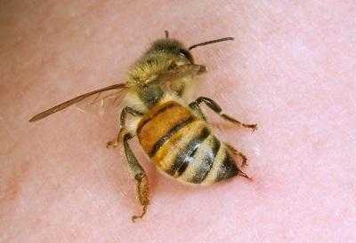 Лечение пчелами: польза и недостатки процедуры. В каких случаях проводят. Схема размещения пчел. Возможные побочные эффекты и противопоказания.