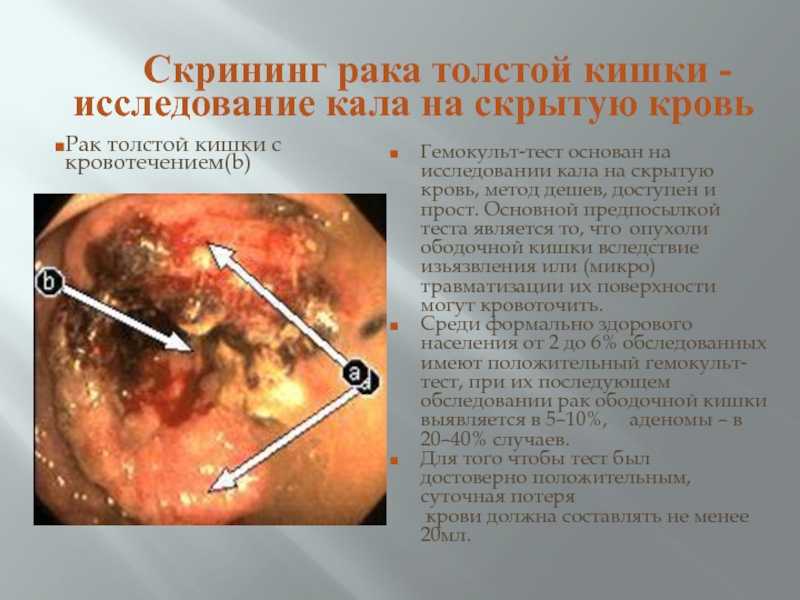 Почечная недостаточность: причины, симптомы и методы лечения