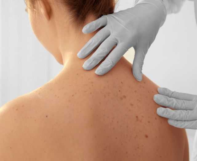 Сыпь на теле: на лице, туловище, руках. основные причины появления сыпи на коже. лечение высыпаний на коже в москве