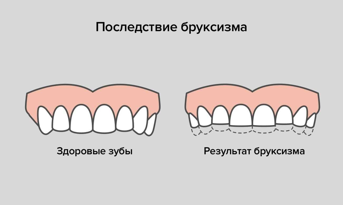 Шатаются зубы: возможные заболевания, причины, способы лечения