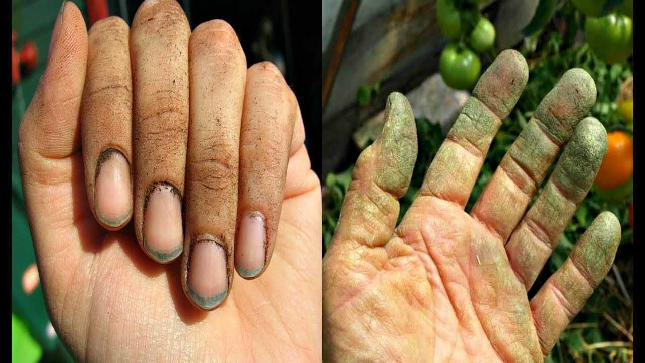 Как очистить руки после очистки грибов. чем и как отмыть руки от грибов маслят и других, в том числе после чистки